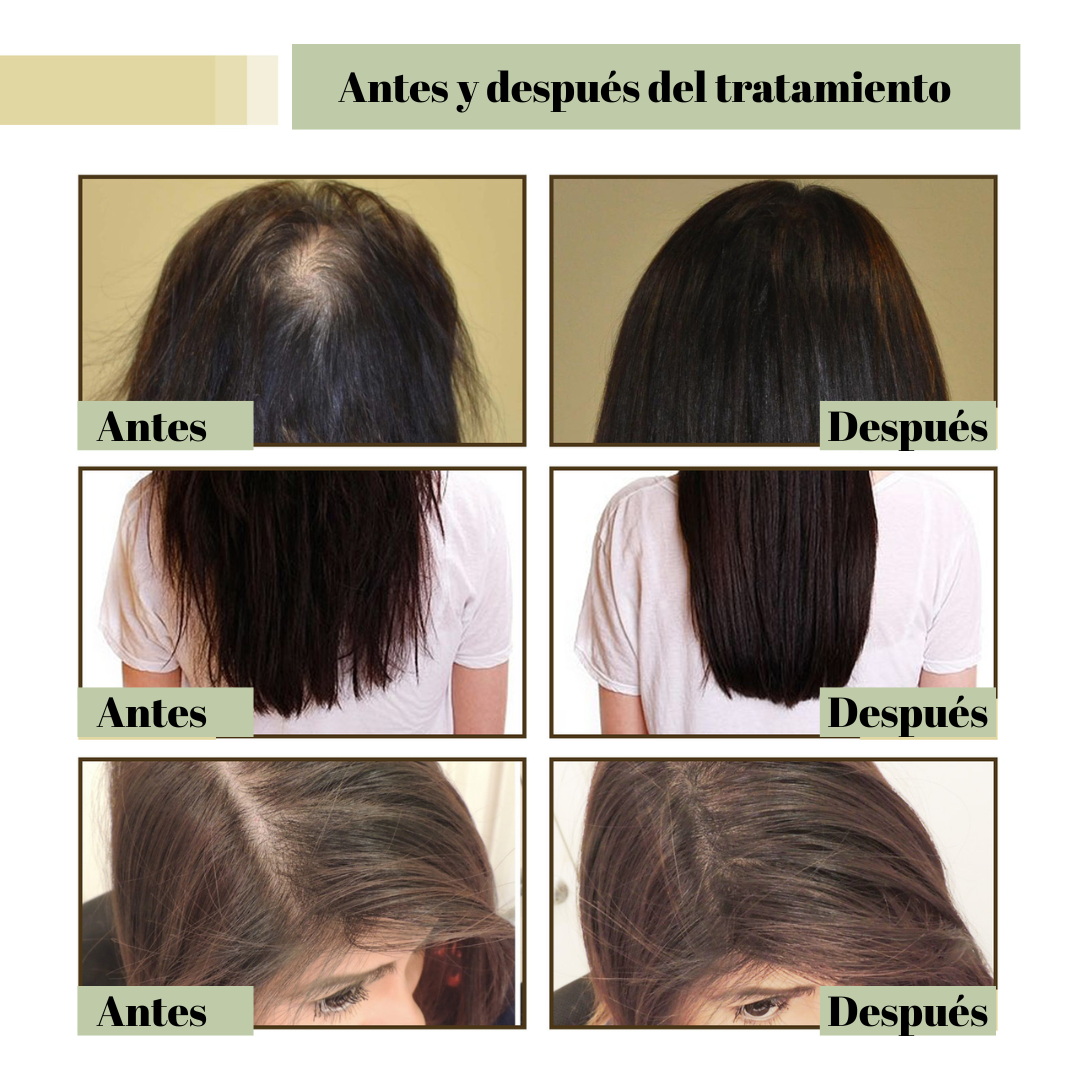 DISAAR®: PACK SHAMPOO + SERUM ANTICAIDA JENGIBRE [50% DESCUENTO]