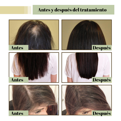 DISAAR®: PACK SHAMPOO + SERUM ANTICAIDA JENGIBRE [50% DESCUENTO]
